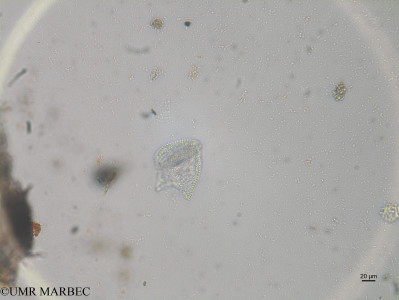 phyto/Brazilian_Nordeste/Northeastcoast_station36/ABRACOS1 October 2015/Phalacroma rapa (st36_Dinophysis mitra170810_004_ovl)(copy)_thumb.jpg